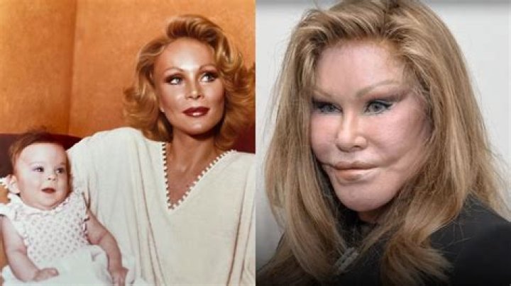 Angel Brinks Before And After Plastic Surgery Photos, How Rich Is Her Baby Daddy?