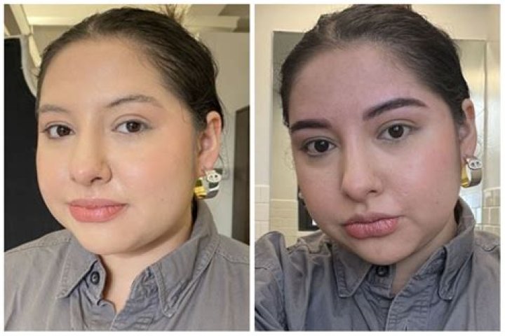 Azi Acosta Surgery, Before And After Pics, Gender Sexuality And Partner