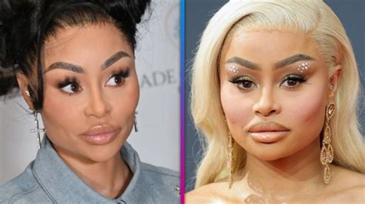 
“Blac Chyna has always been naturally beautiful”: Social media users gush over the model as she dissolves her fillers 