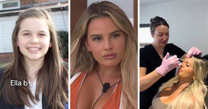 
Coco Lodge Love Island Before Surgery And Nose Job Pictures, Is She Transgender? 