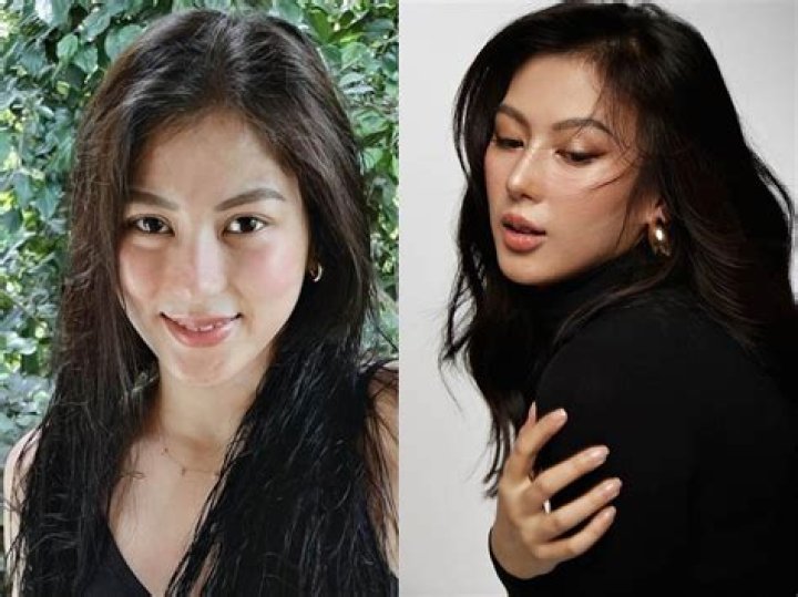 Did Chienna Filomeno Get A Nose Surgery? Filipino Actress Before And After Pictures Revealed