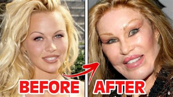 
Did Vanessa Bryant Get Plastic Surgery? Who is Vanessa Bryant? 