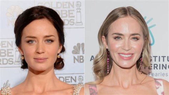 Emily Blunt Botox And Nose Job: Did She Underwent Surgery?