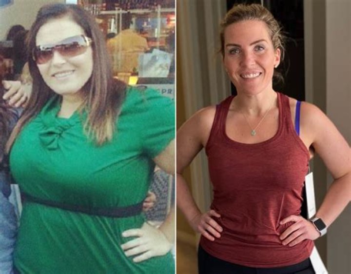 
Faye Winter Before Lips Surgery Pictures, Weight Loss Journey And More 