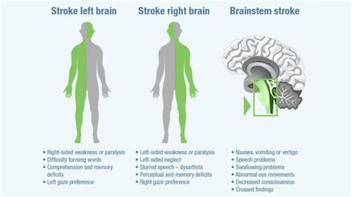 
Had Linda Burney Had Stroke? Slurred Speech Made Us Think She Is Sick 