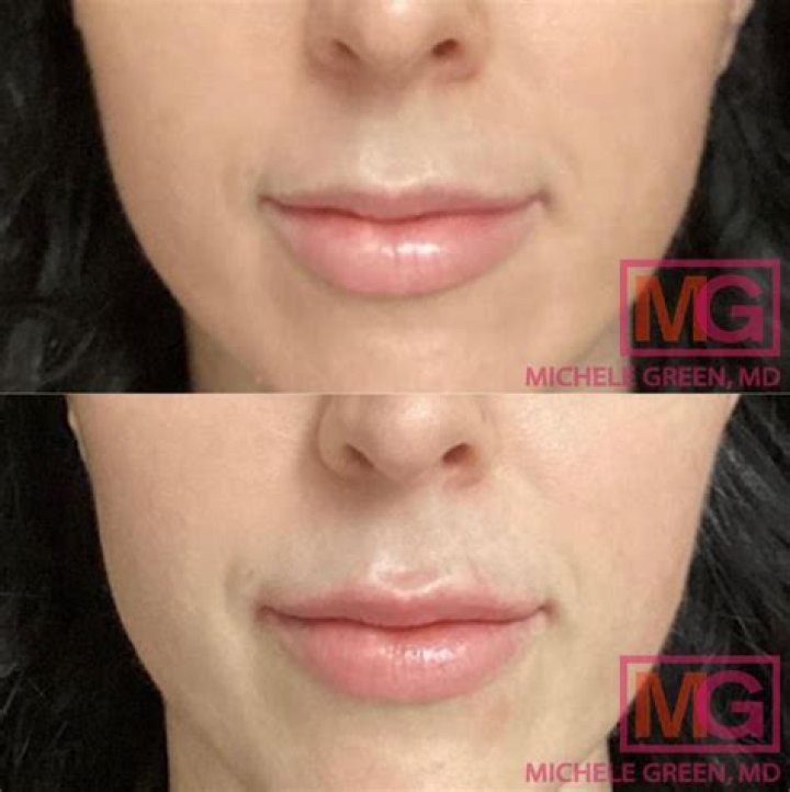 Has Ashley Park Done Plastic Surgery? Fans Suspect Botox And Lip Fillers!