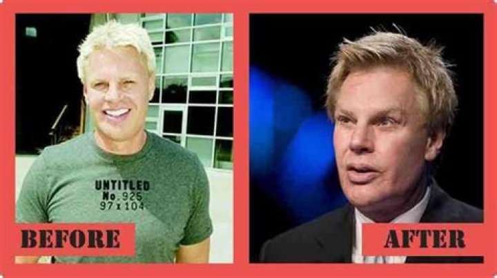 
Has Mike Jeffries Had Plastic Surgery? Details We Know About The Abercrombie & Fitch CEO 