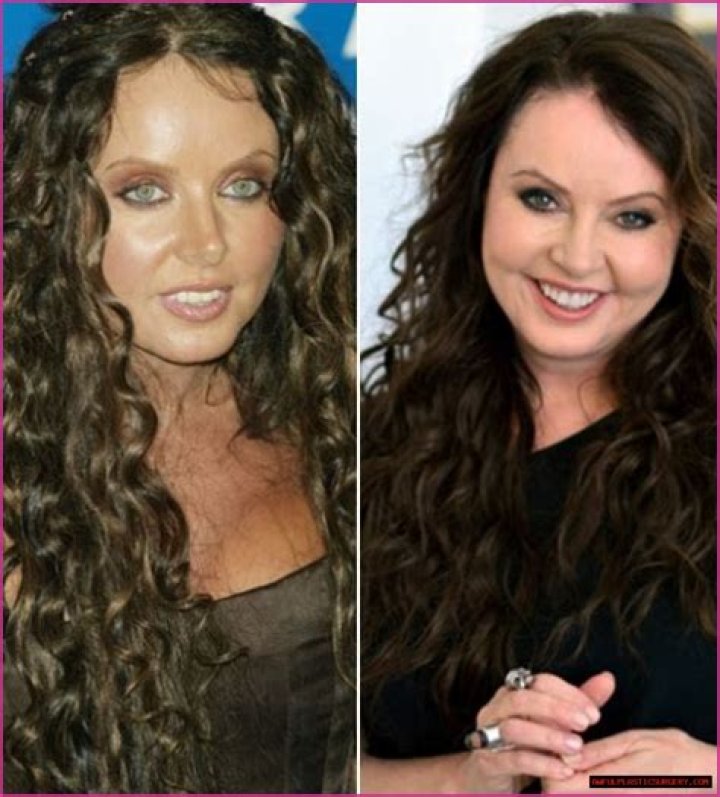 Has Sarah Brightman Had Plastic Surgery? Illness and Puffy Face Explained