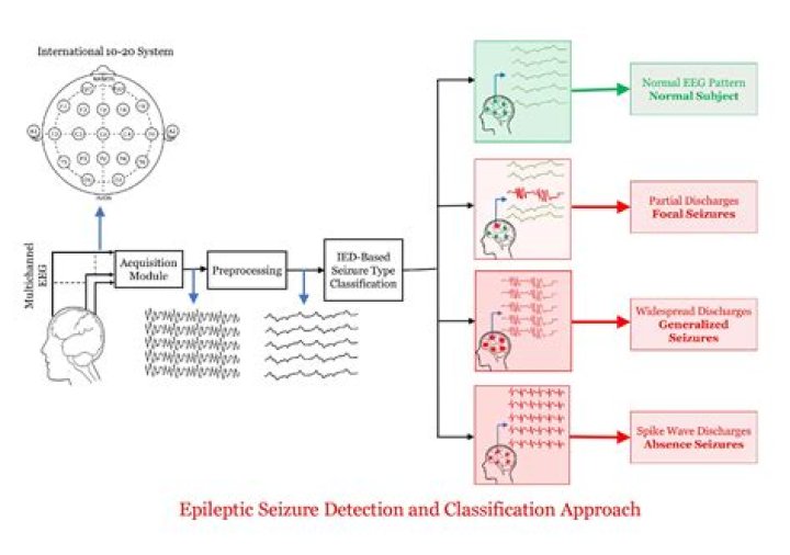 
IISc team develops algorithm to detect seizures 