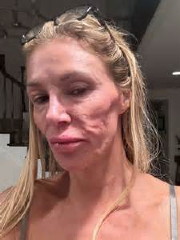 
Is Brandi Glanville Pregnant? Debunking The Online Rumor 