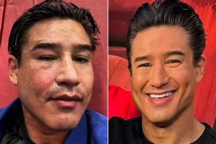 Is Mario Lopez Sick? What Happened To Him- Illness And Health Update