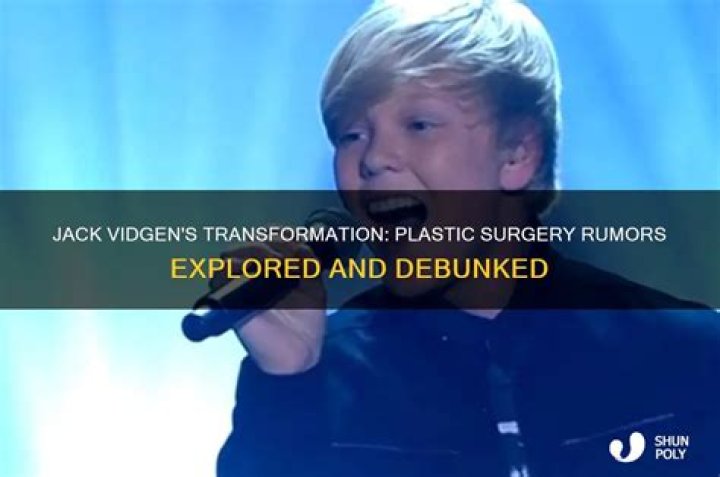 
Jack Vidgen Plastic Surgery Cost Him More Than $15000, Before & After Pictures 
