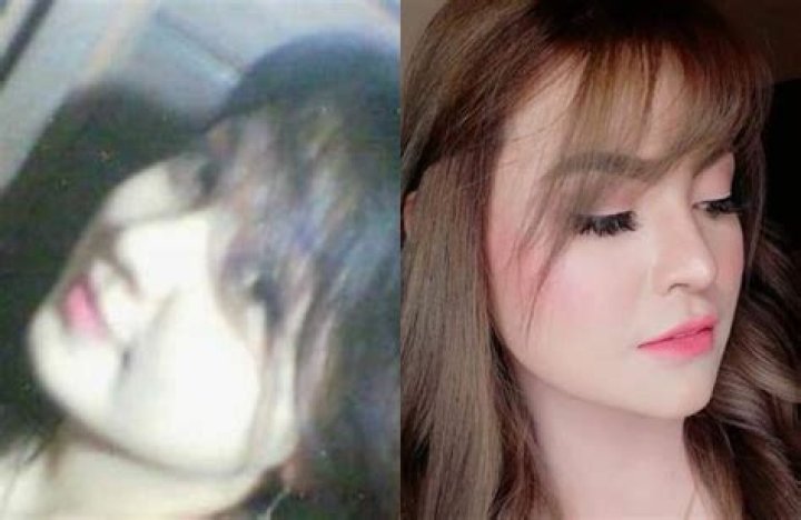 
Lai Austria Before Surgery Pics, Is She Transgender? Boyfriend And Net Worth 