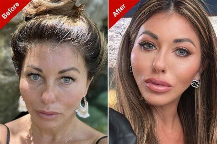 
Mariam Musa Before And After Photos On IG – Has She Done Plastic Surgery? 