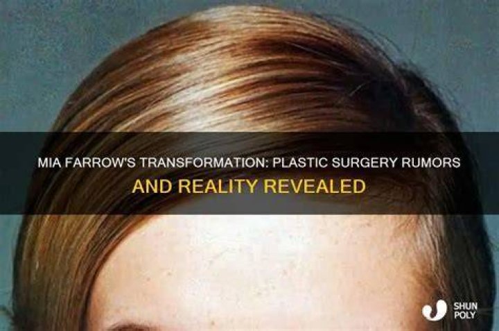 Mia Farrow Plastic Surgery Details – Before And After Pics Revealed