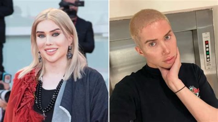 Oli London Before Surgery And Operation, Real Name Age And Wiki