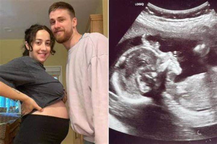 
Singer Still Woozy Wife Pregnant in 2023, Who is Still Woozy Wife? 