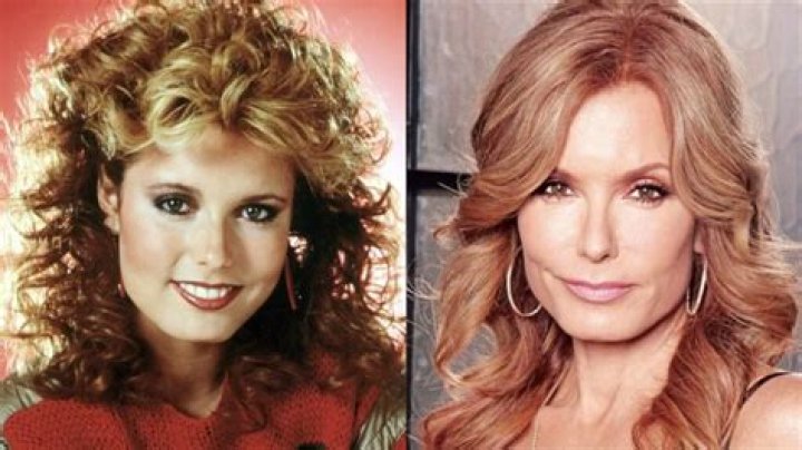Tracey Bregman Plastic Surgery With Impressive Before and After Photos
