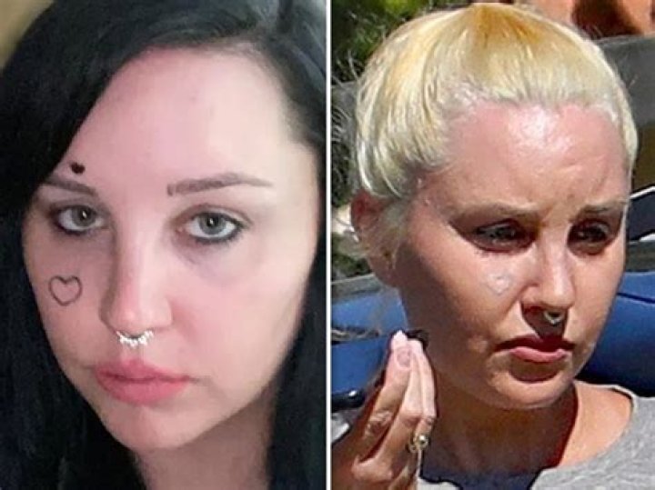 
What Happened To Amanda Bynes? Mental Breakdown Or Same Old Addiction 