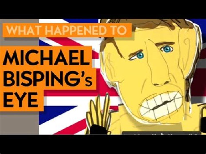 
What Happened To Michael Bisping’s Left Eye, Is He Permanently Blind? 