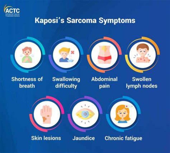 
Who Is Carlos Sarria On TikTok? A Long Battle Of Sarcoma De Ewing Cancer 